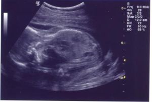 ultrasound2.jpg
