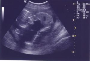 ultrasound3.jpg