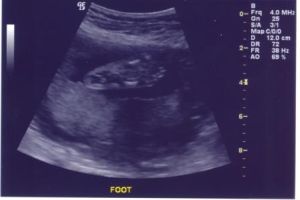 ultrasound7.jpg