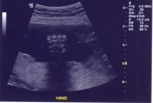 ultrasound8.jpg